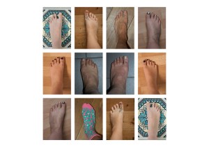 FEET-typology